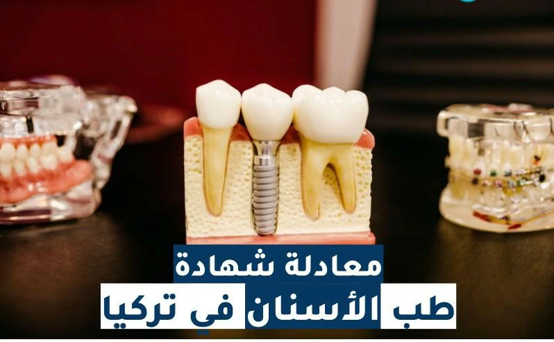 خطوات معادلة شهادة طب الاسنان في تركيا